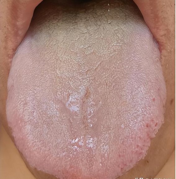 肾虚的真相：为何健脾比补肾更重要