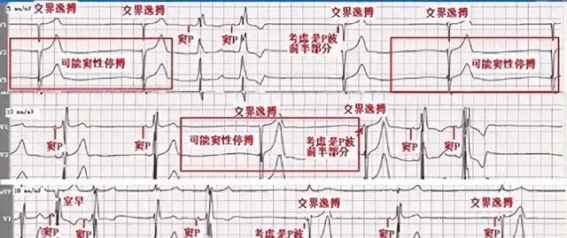 年轻人的健康转折：李华的自我救赎之路