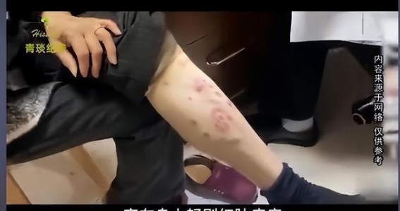 警惕！这些“毒衣服”正悄悄危害你的健康