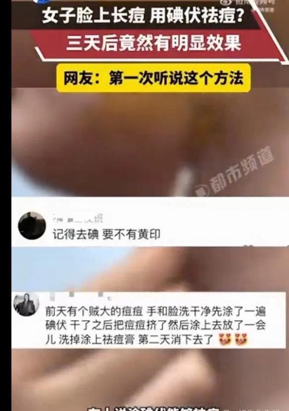 碘伏祛痘是否真有效？专家解析背后的科学依据