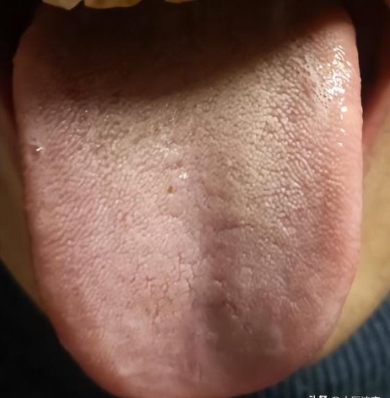痰湿重，阳气不升，肾阳虚如何调理才能恢复海绵体功能？