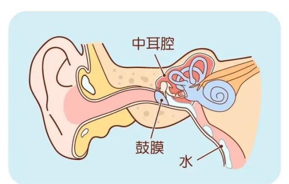 如何正确处理耳朵进水问题