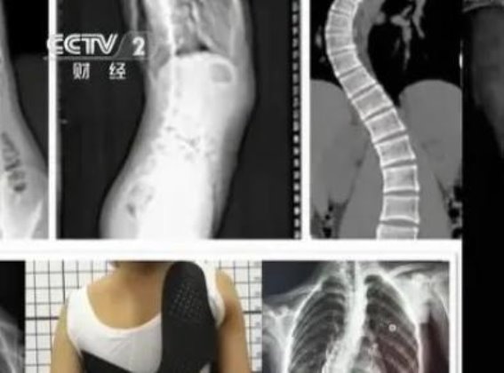 护脊书包的价值探讨：高价是否值得投入？