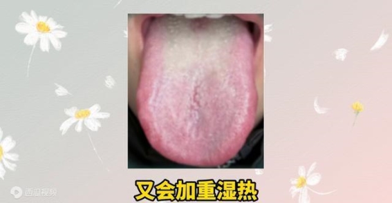 湿热伴阴虚，治疗中的平衡之道