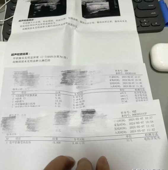 我们被“长新冠”折磨多年，张文宏教授最新研究证实了！