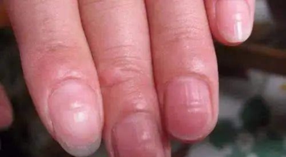 肝不好，留意“1凸、2红”！用好这朵护肝花，肝或越来越好