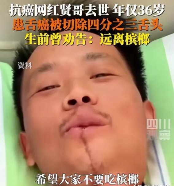 让悲剧警示我们：舌癌带来的反思与呼吁