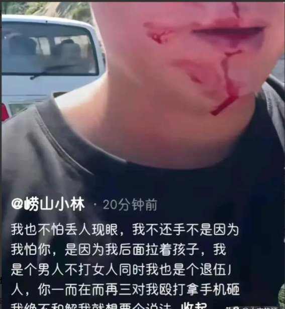 路虎女车主逆行追尾打人：豪车并非特权的代名词