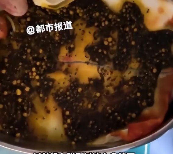 胆囊结石的隐秘危机：一位女性的惊险故事