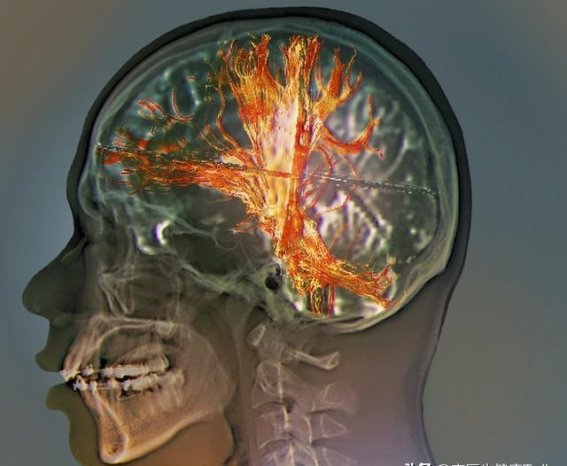 医生提醒：糖尿病早期控制关键，做到这4点，病情不再恶化