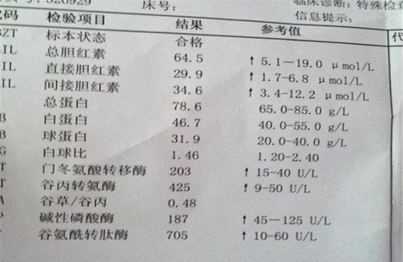 肝病检查中不可忽视的关键指标