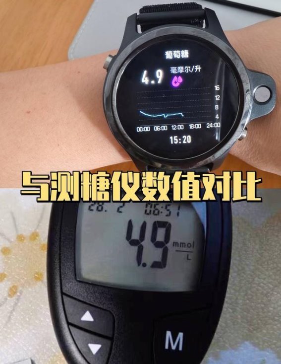 智能血糖监测手表的实际应用价值：糖友的新选择