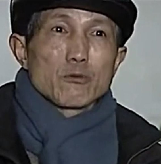 50年无内脏的“活死人”之谜：一场生死边缘的抗争