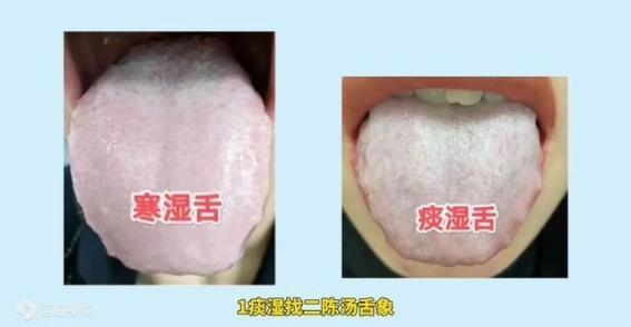 湿气的天敌，痰湿、寒湿、湿热，三药通杀，统统扫除干净！