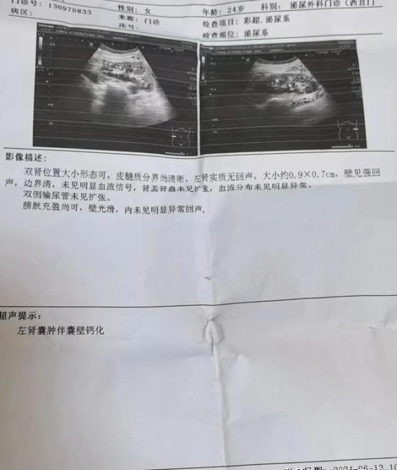 六周中药调理，肾囊肿明显缩小：一个女性患者的治疗经历
