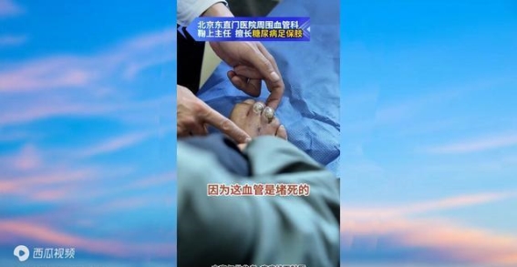 糖尿病足：血管通畅是愈合的关键