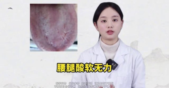识别三种虚证舌象，了解身体的健康信号