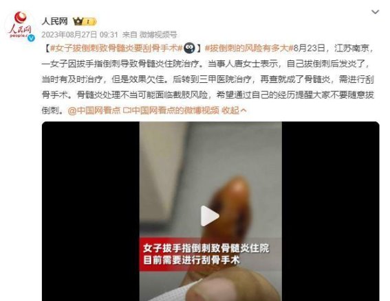 手上长倒刺，千万别随便拔！医生提醒：小心后果严重