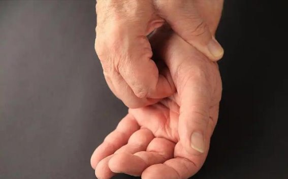 皮肤出现这3种症状，可能是肾脏在“求救”
