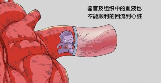 冠心病的隐患与防范：警惕三大并发症的影响