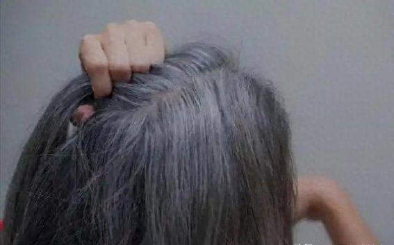 身体的“白发警报”：你忽视的健康信号，可能比你想象的更重要