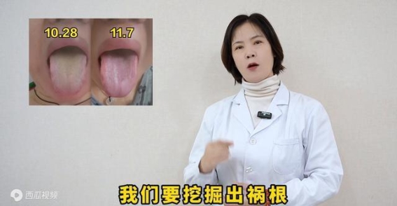 10天，三步让你的舌象焕然一新