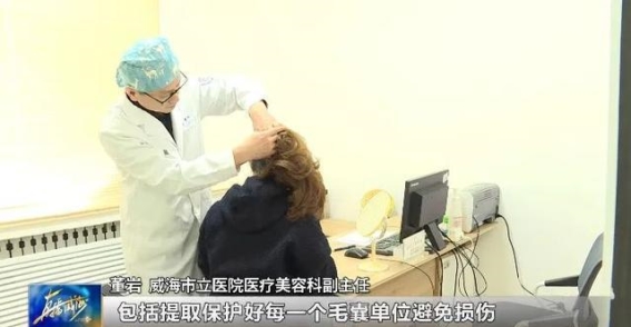 头顶问题不可小觑，植发那些你必须知道的事