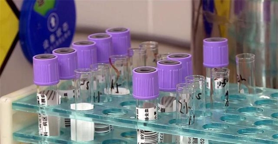 全球首例罕见血型基因突变在柳州被发现
