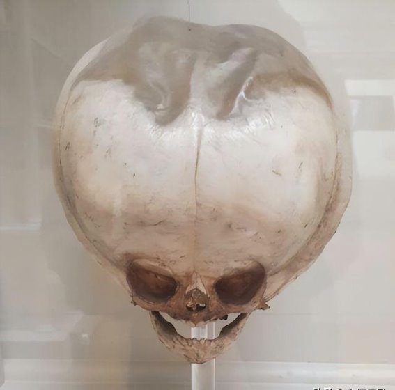 时代的剪影：30张历史图片展现的世界变迁