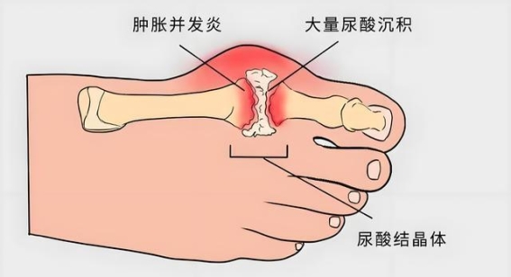 季德胜蛇药片：多方位解读这款传统草药的神奇功效