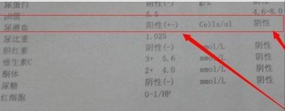血尿原因和应对措施