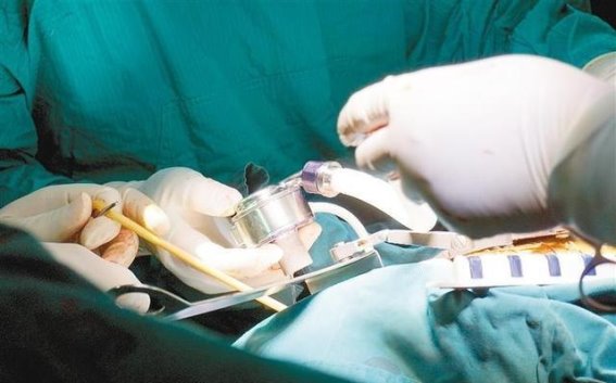 心脏不停跳，机械心成生命之源