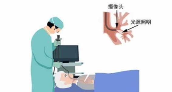 济南市儿童医院开设支气管镜门诊，为儿童呼吸健康护航