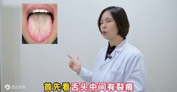 舌头上的三大警示，揭示身体健康的隐患