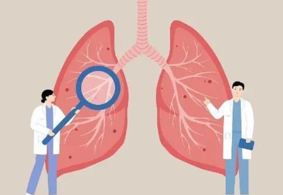 秋季养肺指南：三种食物与六个妙招，呵护你的肺脏